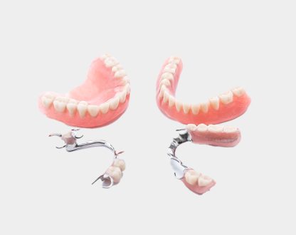 When Are Partial Dentures the Best Option for Missing Teeth?
