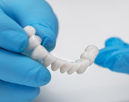How Tooth Bridges Restore Missing Teeth Without Surgery