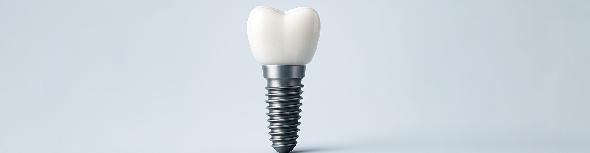 Do Dental Implants Hurt? Myths vs. Reality