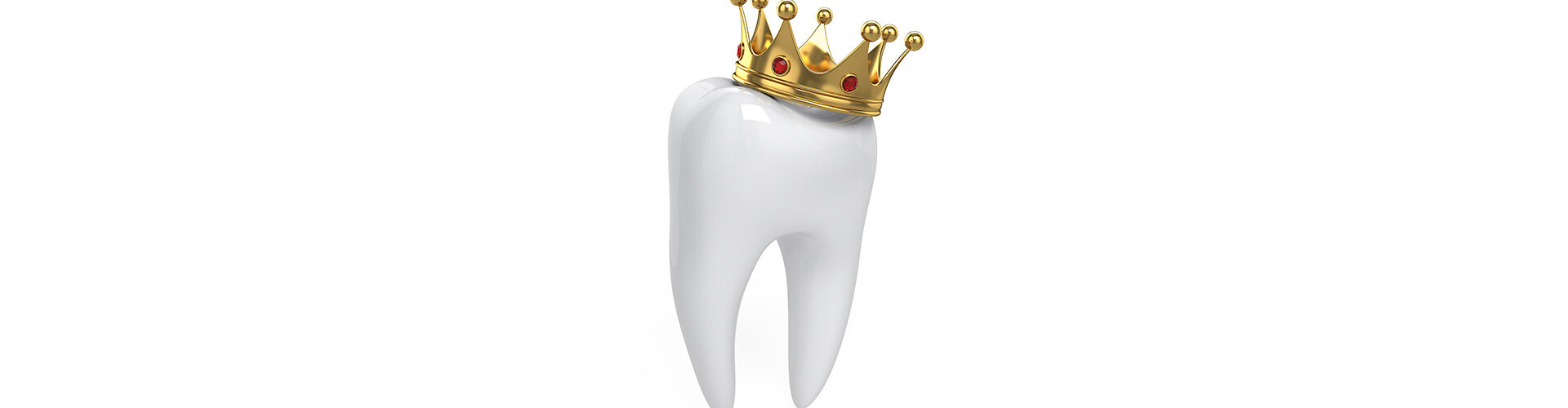 The Process of Getting Front Tooth Crowns: What to Expect