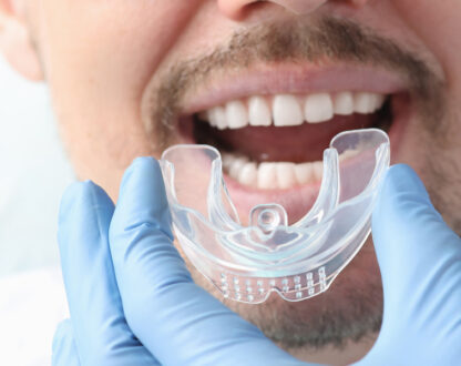 Occlusal Mouth Guards: Protect Your Teeth from Grinding