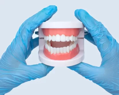 The Benefits of Using Interim Dentures Before Permanent Ones