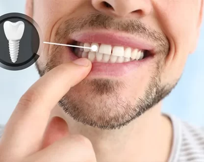 Why-Dental-Implants-Do-More-Than-Fill-a-Gap-in-Your-Smile