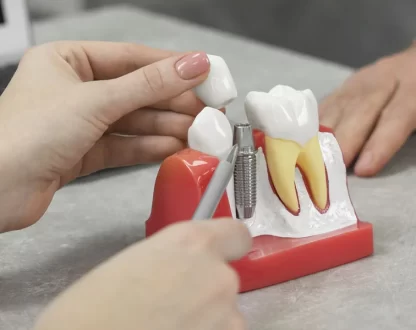 How Dental Implants Can Improve Your Total Health