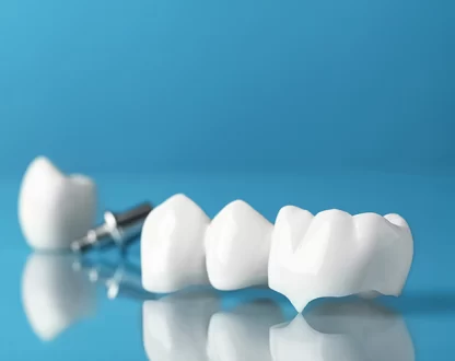 How Dental Crowns Restore Function After Severe Tooth Wear